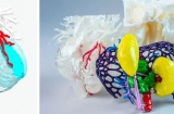 医学3D打印用于创建用于诊断和手术规划的个性化3D解剖